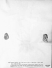 Ochrolechia parella image